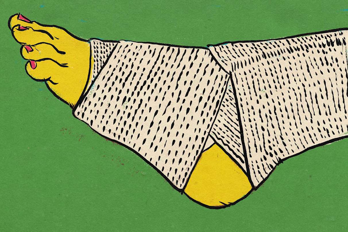 Alles, was du über Stressfrakturen wissen solltest