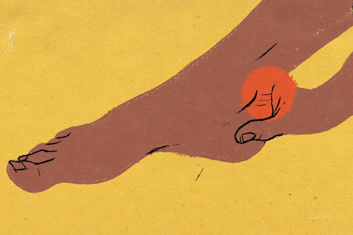 Tendonitis vs. Tendinosis: How To Prevent and Treat Both