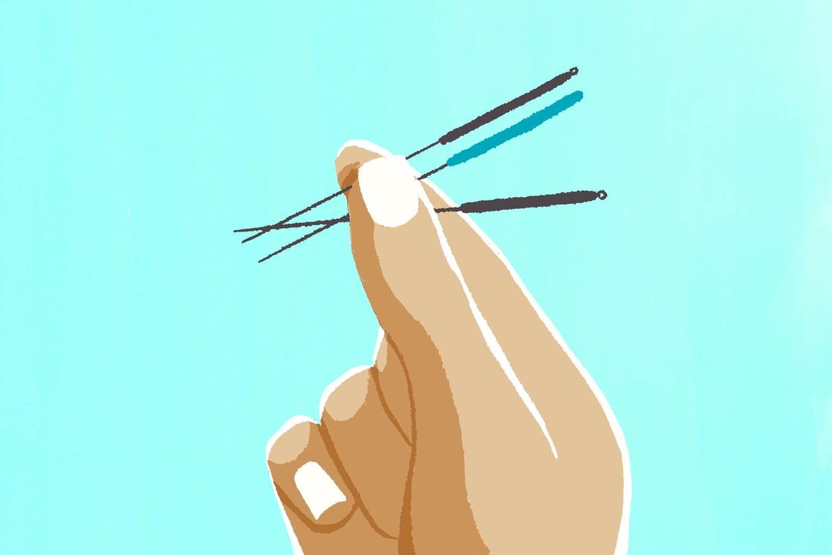 Punción seca y acupuntura: todo lo que necesitas saber