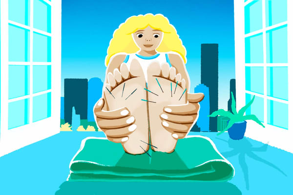 Dry needling et acupuncture : tout ce que vous devez savoir